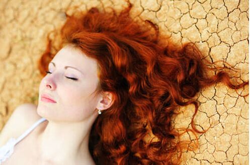Girl with psoriasis